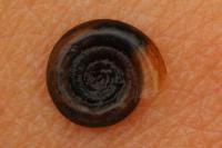 Anisus vortex