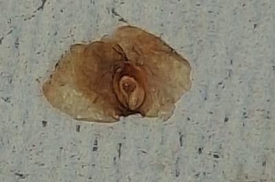 <i>Semudobia betulae</i>